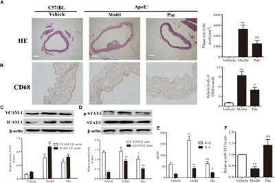 Paeonol Attenuated Inflammatory Response of Endothelial Cells via Stimulating Monocytes-Derived Exosomal MicroRNA-223